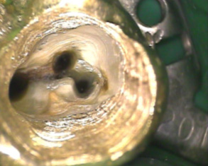 Wurzelfüllung Endodontie