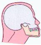 Bionator