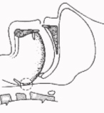 Protrusionsschiene